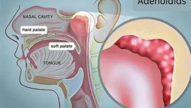 Adenoidid