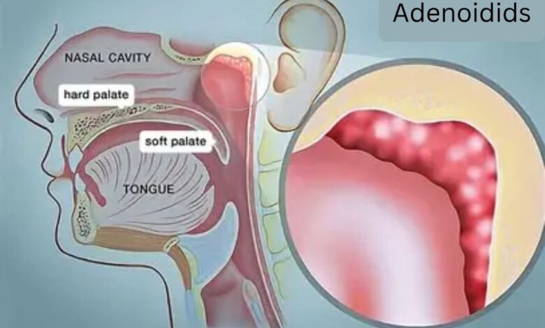 Adenoidid